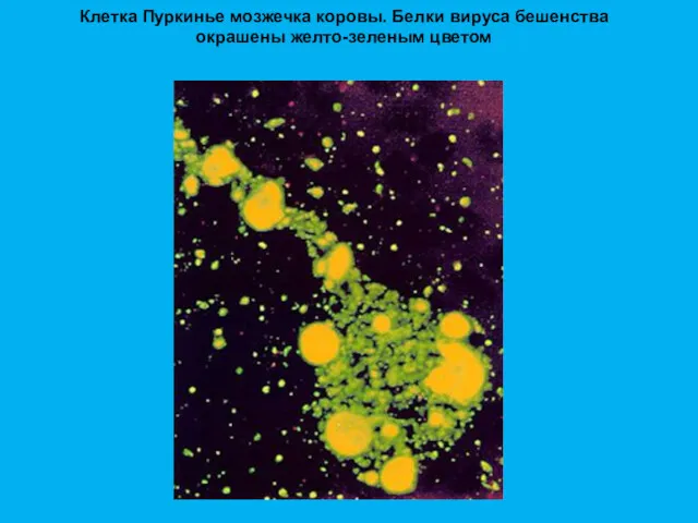 Клетка Пуркинье мозжечка коровы. Белки вируса бешенства окрашены желто-зеленым цветом