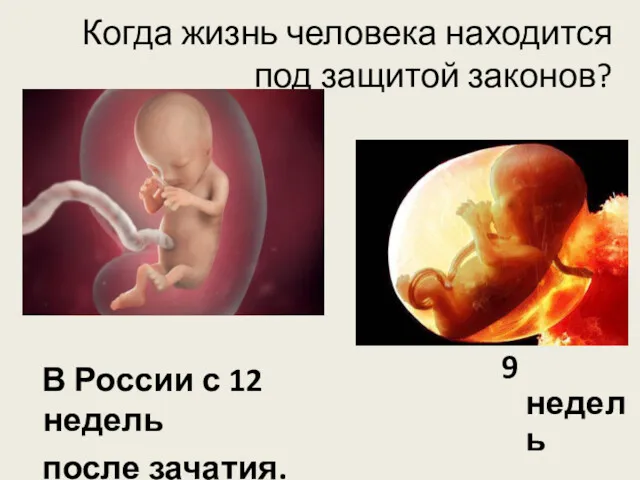 Когда жизнь человека находится под защитой законов? В России с 12 недель после зачатия. 9 недель