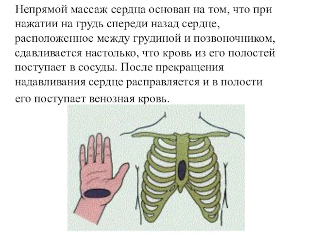 Непрямой массаж сердца основан на том, что при нажатии на