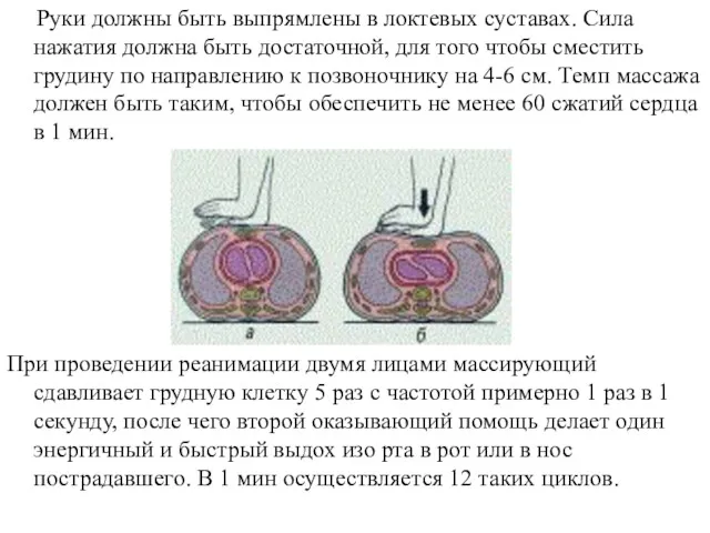 Руки должны быть выпрямлены в локтевых суставах. Сила нажатия должна