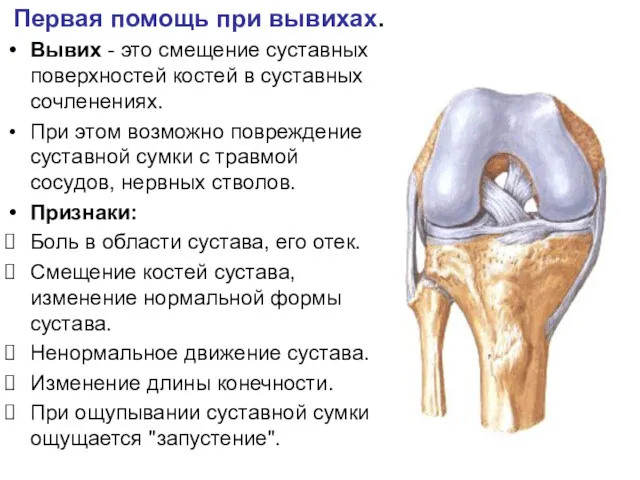 Первая помощь при вывихах. Вывих - это смещение суставных поверхностей