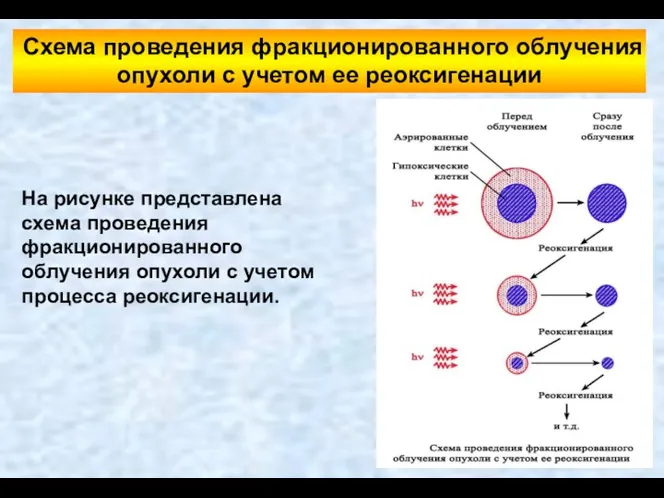 На рисунке представлена схема проведения фракционированного облучения опухоли с учетом