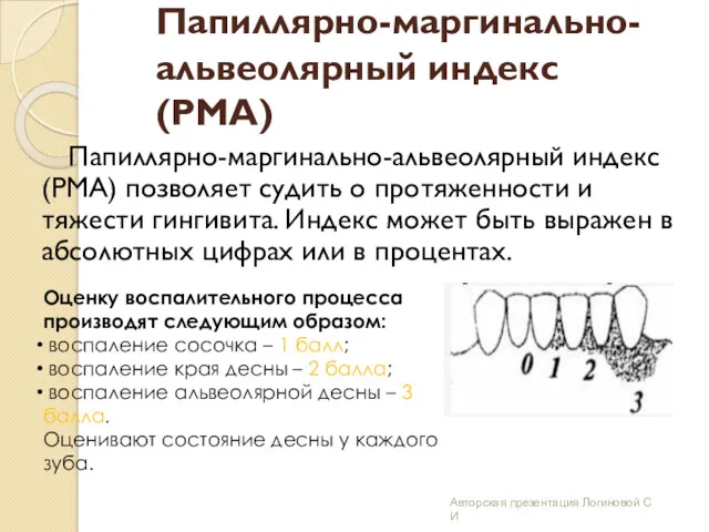 Папиллярно-маргинально-альвеолярный индекс (PMA) Папиллярно-маргинально-альвеолярный индекс (РМА) позволяет судить о протяженности