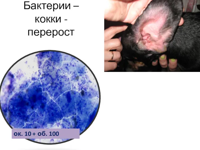 Бактерии – кокки - перерост ок. 10 + об. 100