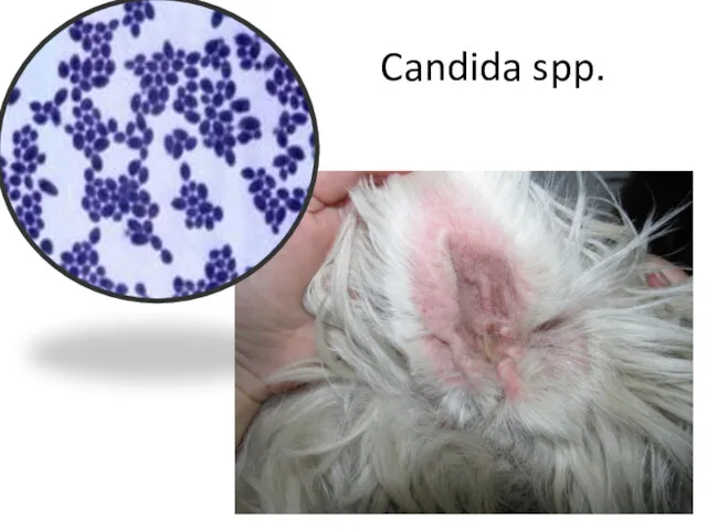 Candida spp.