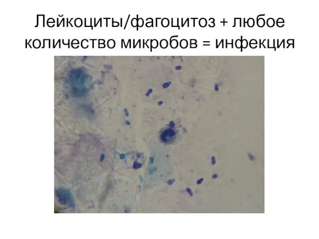 Лейкоциты/фагоцитоз + любое количество микробов = инфекция