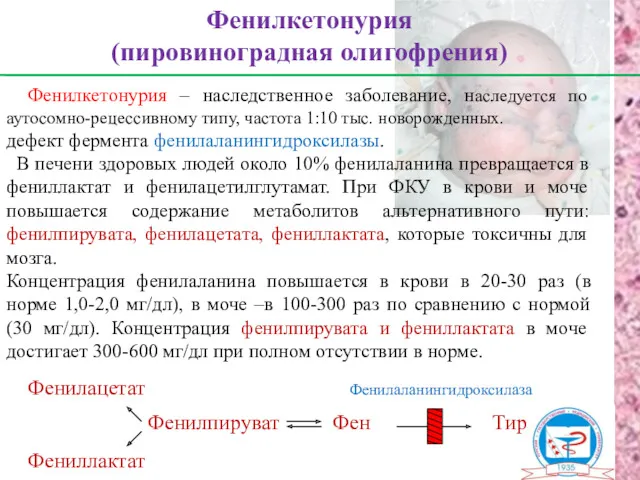 Фенилкетонурия – наследственное заболевание, наследуется по аутосомно-рецессивному типу, частота 1:10