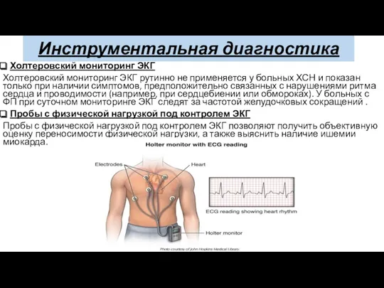 Инструментальная диагностика Холтеровский мониторинг ЭКГ Холтеровский мониторинг ЭКГ рутинно не