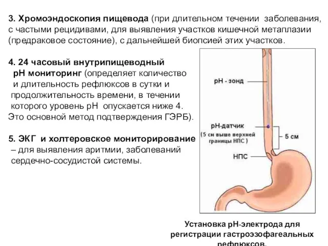 3. Хромоэндоскопия пищевода (при длительном течении заболевания, с частыми рецидивами,