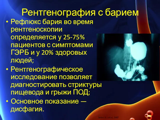 Рентгенография с барием Рефлюкс бария во время рентгеноскопии определяется у 25-75% пациентов с