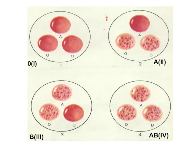 0(I) A(II) B(III) AB(IV)