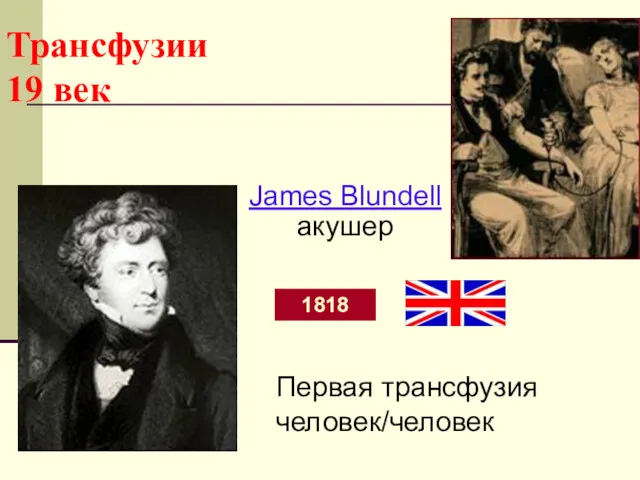 Трансфузии 19 век 1818 James Blundell акушер Первая трансфузия человек/человек