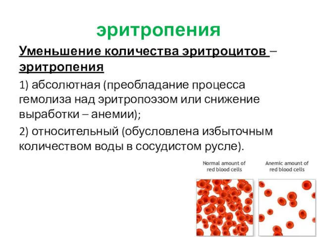 эритропения Уменьшение количества эритроцитов – эритропения 1) абсолютная (преобладание процесса