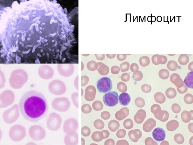 Лимфоцит