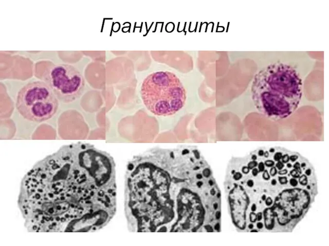 Гранулоциты