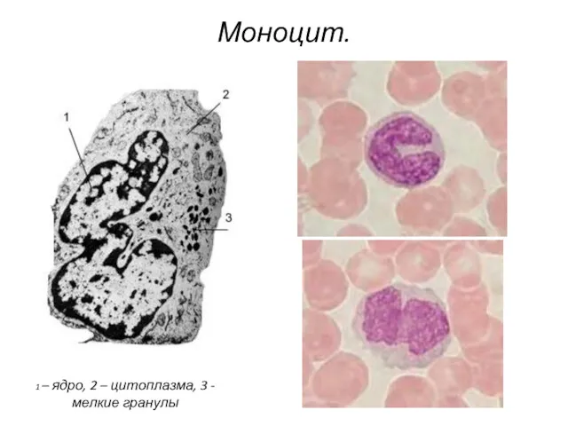 1 – ядро, 2 – цитоплазма, 3 - мелкие гранулы Моноцит.