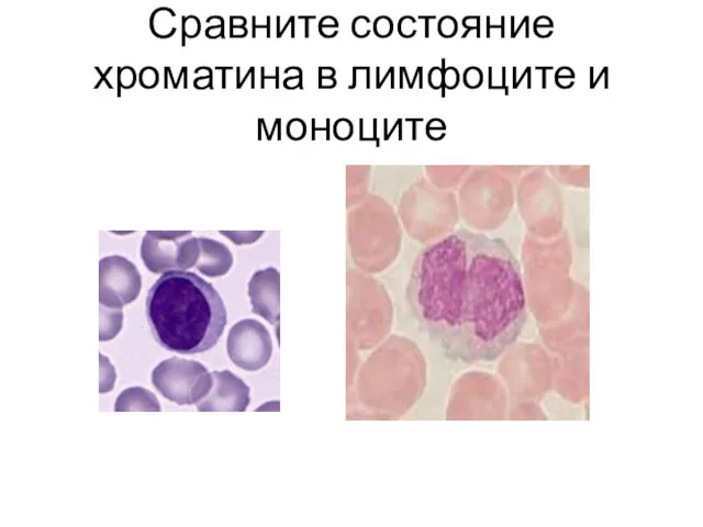 Сравните состояние хроматина в лимфоците и моноците