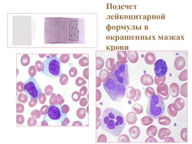 Подсчет лейкоцитарной формулы в окрашенных мазках крови