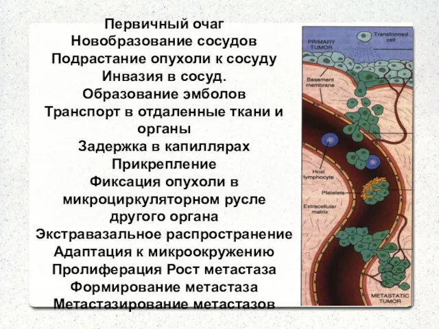 Первичный очаг Новобразование сосудов Подрастание опухоли к сосуду Инвазия в