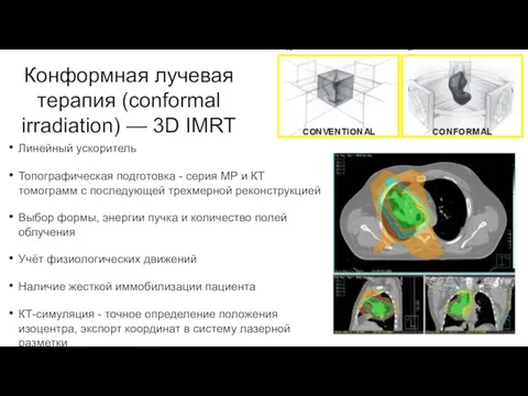 Конформная лучевая терапия (conformal irradiation) — 3D IMRT Линейный ускоритель