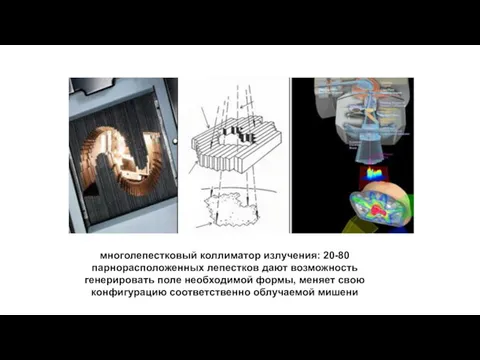 многолепестковый коллиматор излучения: 20-80 парнорасположенных лепестков дают возможность генерировать поле