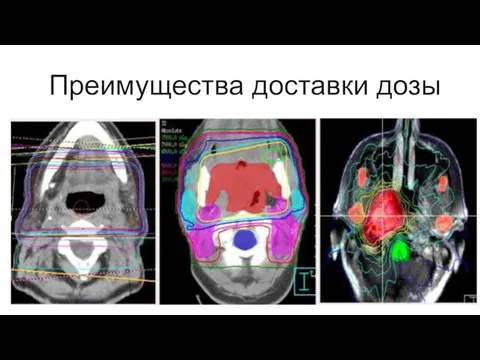 Преимущества доставки дозы