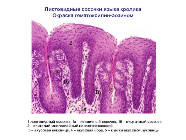 Листовидные сосочки языка кролика Окраска гематоксилин-эозином 1 листовидный сосочек, 1а