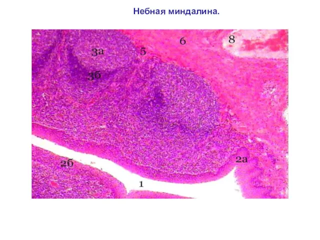 Небная миндалина.