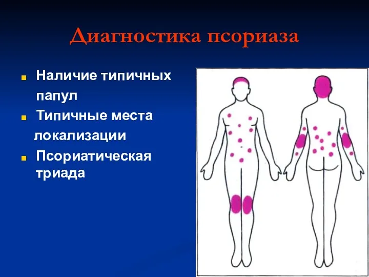 Диагностика псориаза Наличие типичных папул Типичные места локализации Псориатическая триада