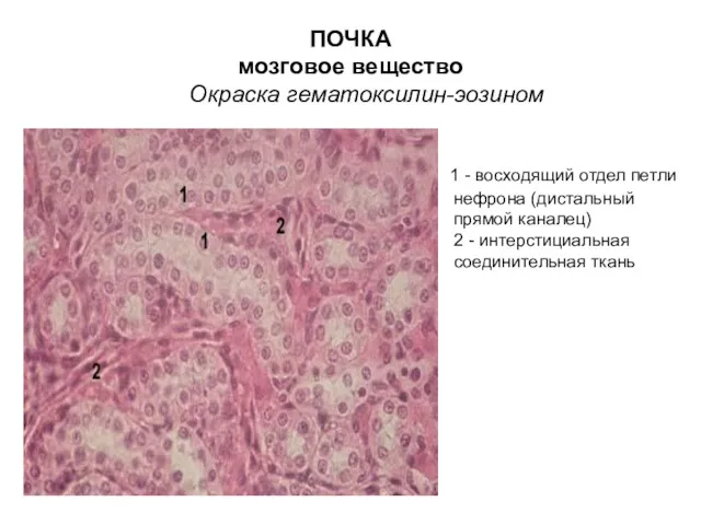 ПОЧКА мозговое вещество Окраска гематоксилин-эозином 1 - восходящий отдел петли нефрона (дистальный прямой