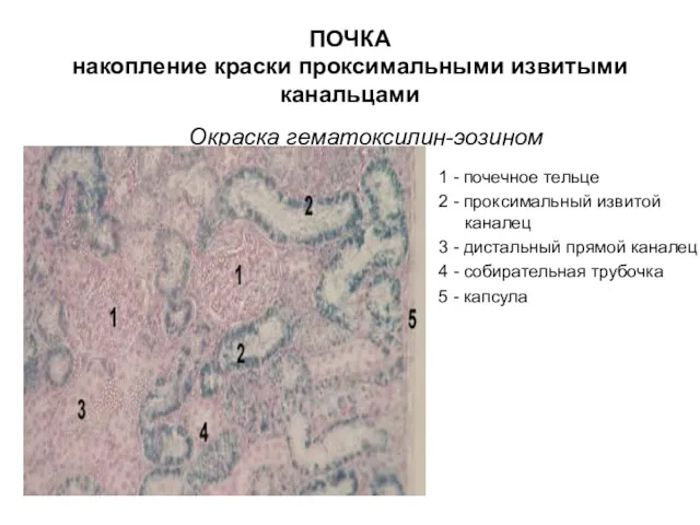 ПОЧКА накопление краски проксимальными извитыми канальцами Окраска гематоксилин-эозином 1 - почечное тельце 2