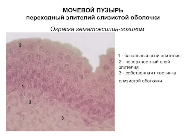 МОЧЕВОЙ ПУЗЫРЬ переходный эпителий слизистой оболочки Окраска гематоксилин-эозином 1 - базальный слой эпителия