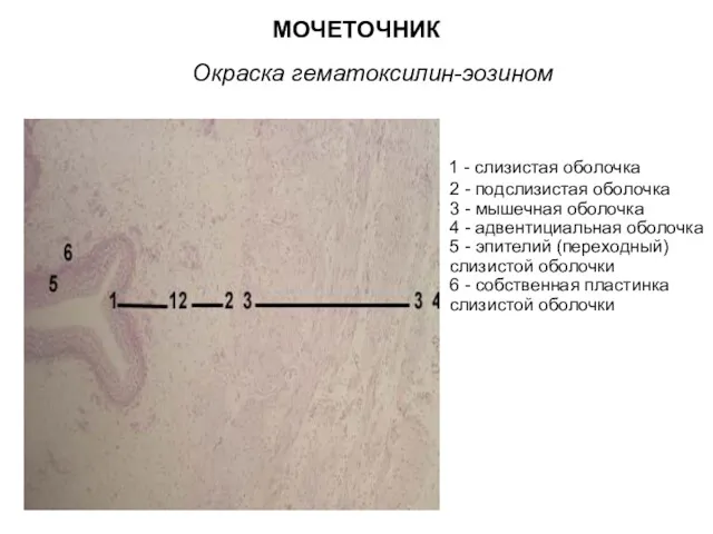 МОЧЕТОЧНИК Окраска гематоксилин-эозином 1 - слизистая оболочка 2 - подслизистая оболочка 3 -