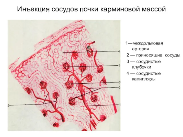 Инъекция сосудов почки карминовой массой 1—междольковая артерия 2 — приносящие сосуды 3 —