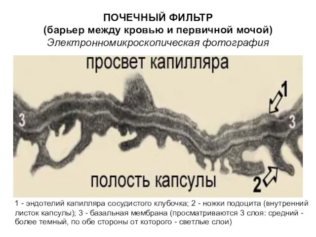 ПОЧЕЧНЫЙ ФИЛЬТР (барьер между кровью и первичной мочой) Электронномикроскопическая фотография 1 - эндотелий