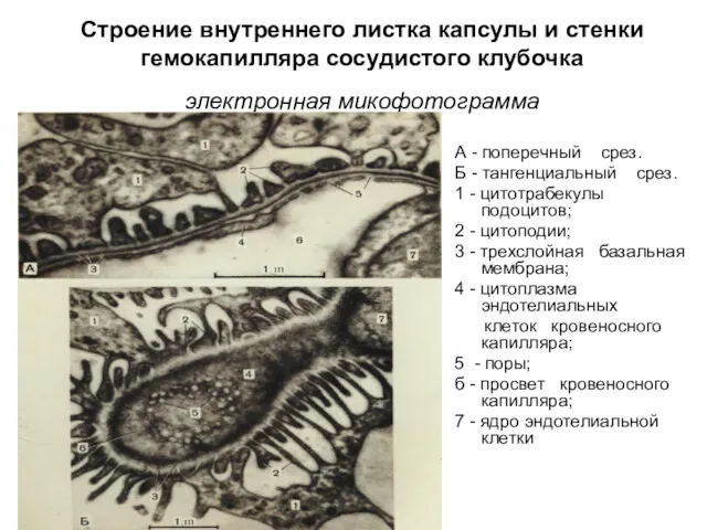 Строение внутреннего листка капсулы и стенки гемокапилляра сосудистого клубочка электронная микофотограмма А -