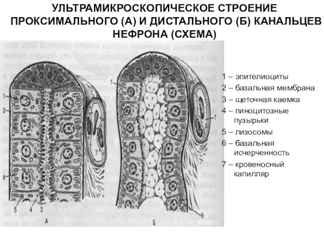 УЛЬТРАМИКРОСКОПИЧЕСКОЕ СТРОЕНИЕ ПРОКСИМАЛЬНОГО (А) И ДИСТАЛЬНОГО (Б) КАНАЛЬЦЕВ НЕФРОНА (СХЕМА) 1 – эпителиоциты
