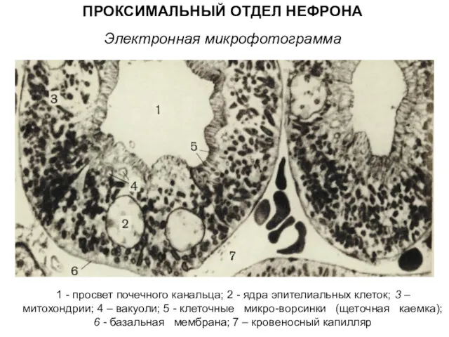 ПРОКСИМАЛЬНЫЙ ОТДЕЛ НЕФРОНА Электронная микрофотограмма 1 - просвет почечного канальца; 2 - ядра
