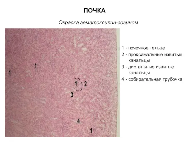 ПОЧКА Окраска гематоксилин-эозином 1 - почечное тельце 2 - проксимальные извитые канальцы 3