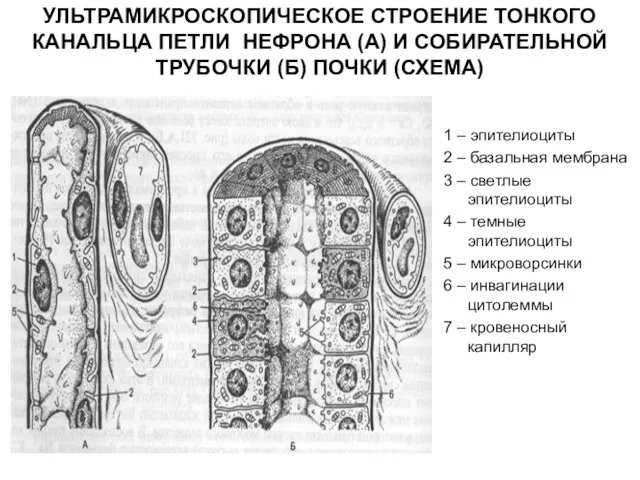УЛЬТРАМИКРОСКОПИЧЕСКОЕ СТРОЕНИЕ ТОНКОГО КАНАЛЬЦА ПЕТЛИ НЕФРОНА (А) И СОБИРАТЕЛЬНОЙ ТРУБОЧКИ (Б) ПОЧКИ (СХЕМА)