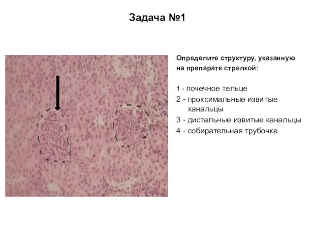 Определите структуру, указанную на препарате стрелкой: 1 - почечное тельце 2 - проксимальные