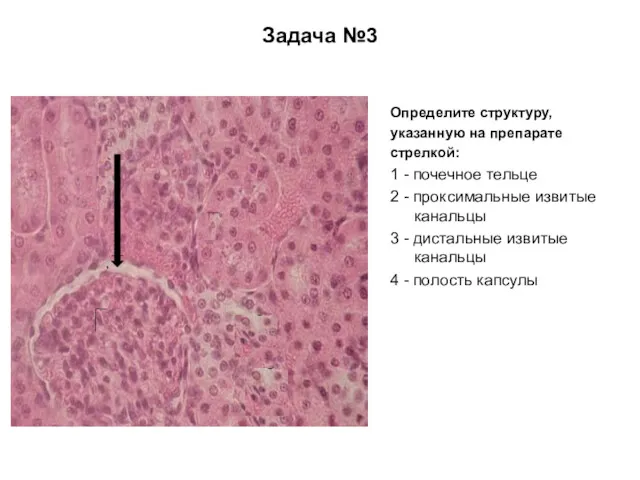 Задача №3 Определите структуру, указанную на препарате стрелкой: 1 - почечное тельце 2