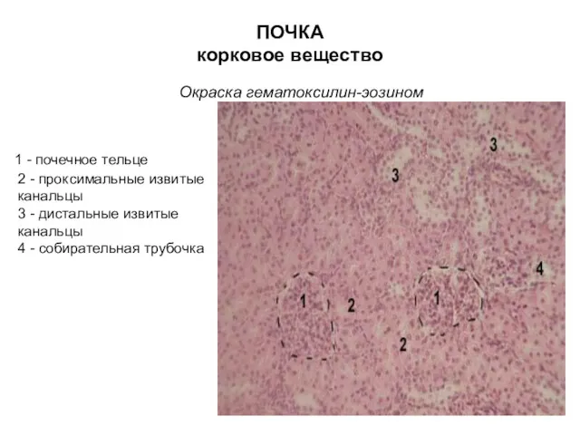 ПОЧКА корковое вещество Окраска гематоксилин-эозином 1 - почечное тельце 2 - проксимальные извитые