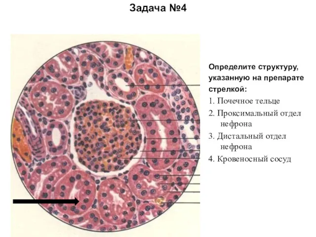 Задача №4 Определите структуру, указанную на препарате стрелкой: 1. Почечное тельце 2. Проксимальный