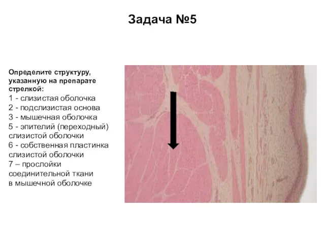 Задача №5 Определите структуру, указанную на препарате стрелкой: 1 - слизистая оболочка 2