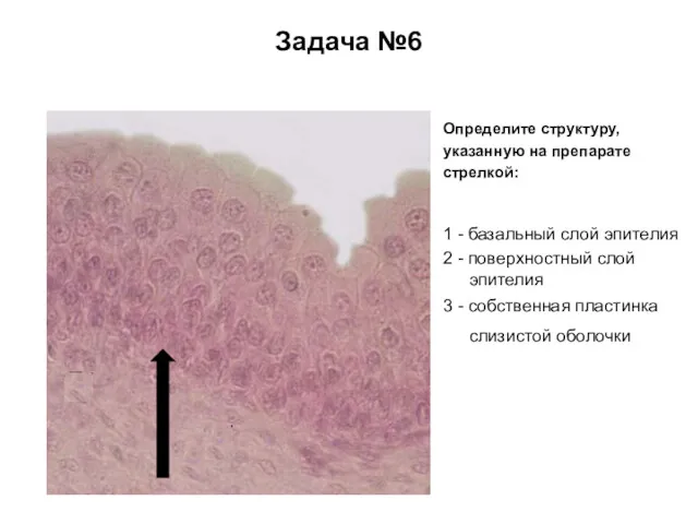 Задача №6 Определите структуру, указанную на препарате стрелкой: 1 - базальный слой эпителия