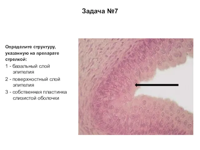 Задача №7 Определите структуру, указанную на препарате стрелкой: 1 - базальный слой эпителия