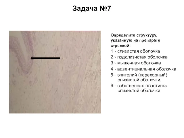 Задача №7 Определите структуру, указанную на препарате стрелкой: 1 - слизистая оболочка 2