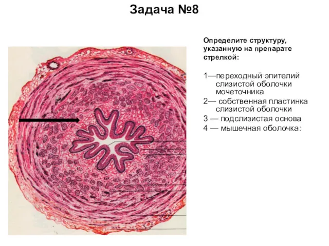 Задача №8 Определите структуру, указанную на препарате стрелкой: 1—переходный эпителий слизистой оболочки мочеточника