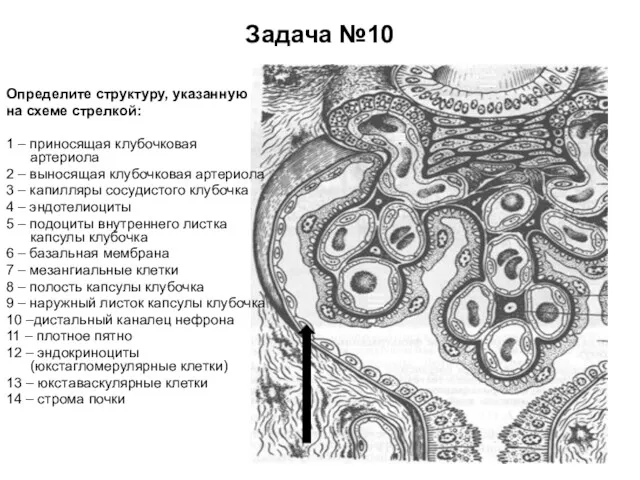 Задача №10 Определите структуру, указанную на схеме стрелкой: 1 – приносящая клубочковая артериола